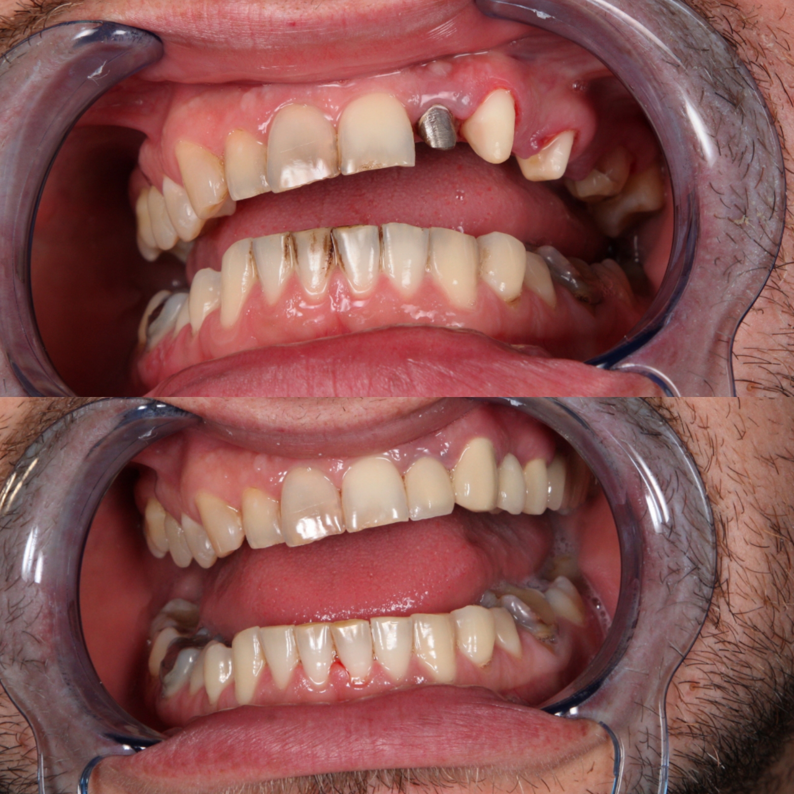 zena kod stomatologa