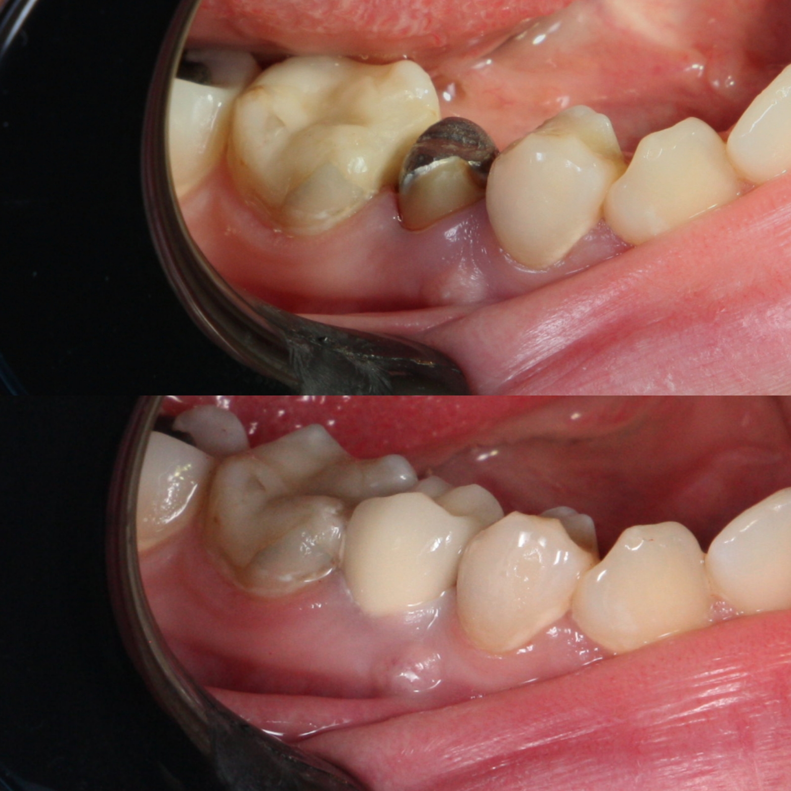 malo dete i stomatolog