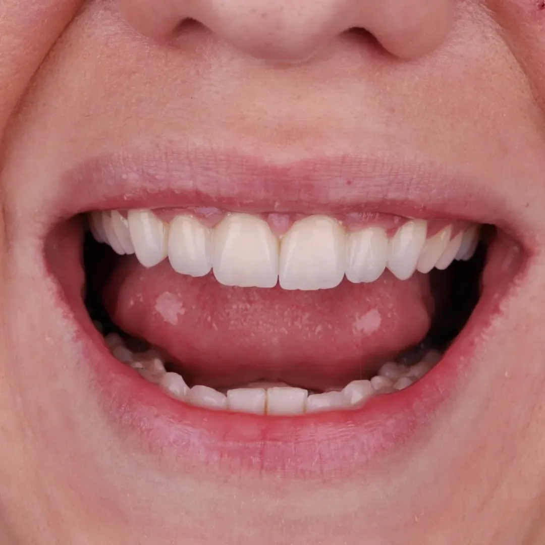 malo dete i stomatolog